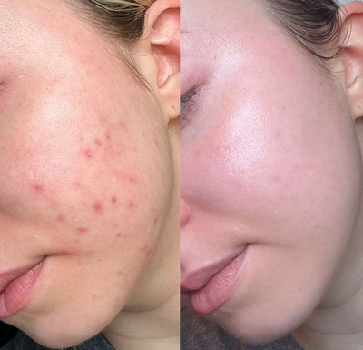 Before and after 3