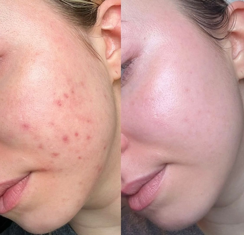Before and after 3